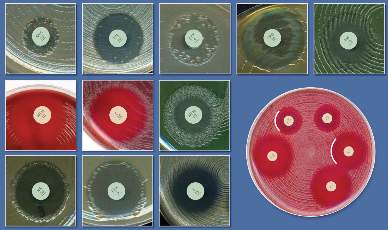 Российские рекомендации по определению чувствительности 2025